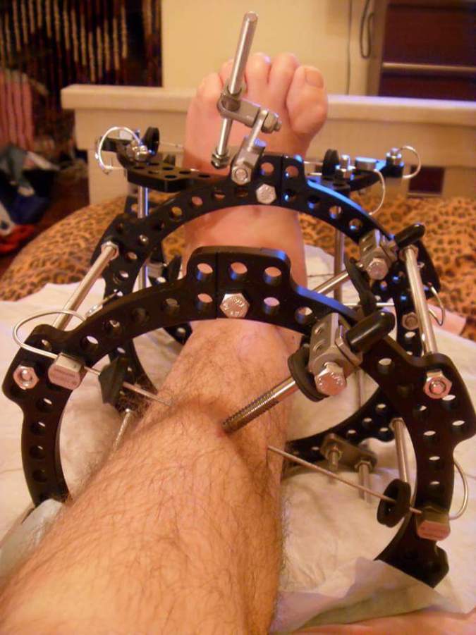 FB_IMG_1473623583818